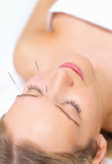 Acupuncture for Facial Rejuvenation